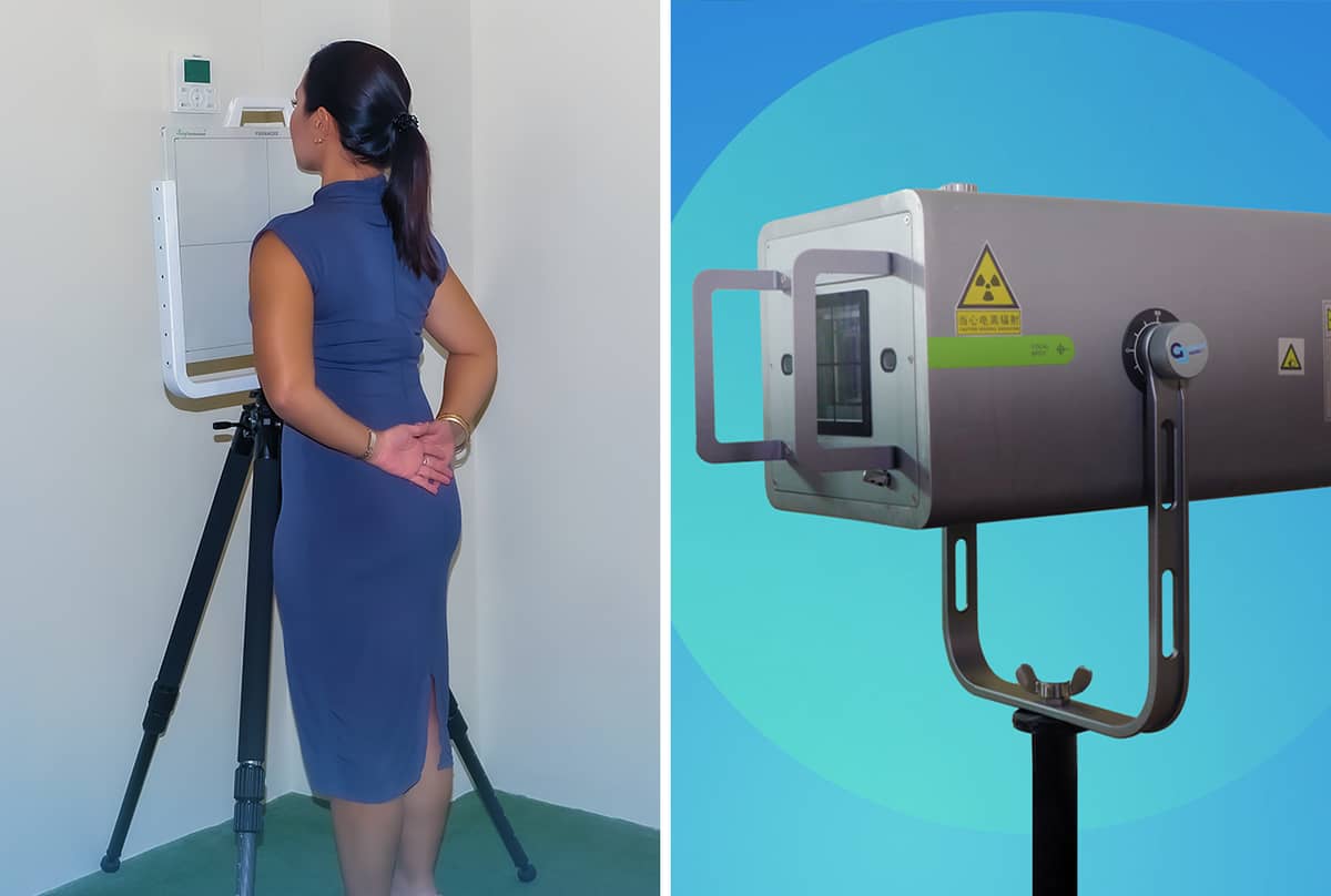 Using AI technology, AI Smart Scan has the ability to filter between normal and abnormal cases for easy detection and create reports based on initial insights from the radiologist and AI Smart Scan, a portable AI-driven x-ray.